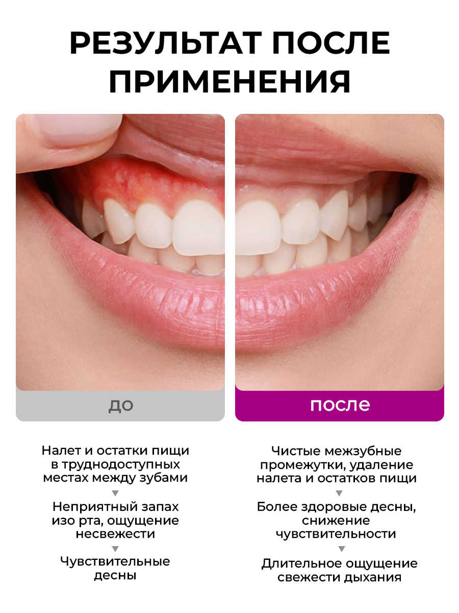 Жидкость для ирригатора STOMATOL Sensitive 500 мл - фото 6