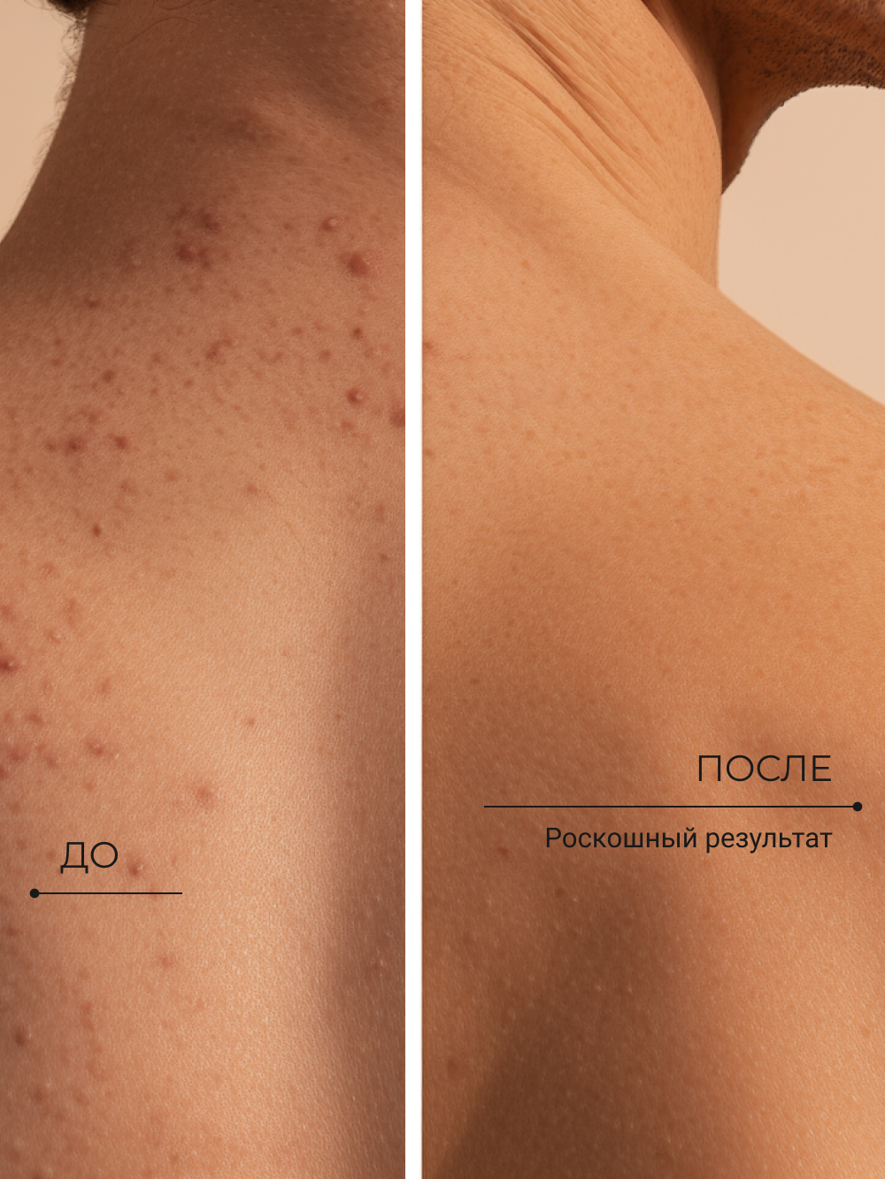 Гель Zeitun 250 мл - фото 7