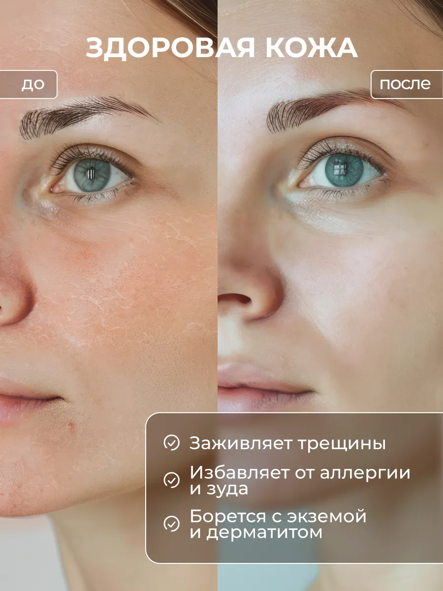 Био масло для кутикулы Qtix экстракт монарды и зелёный чай - фото 3