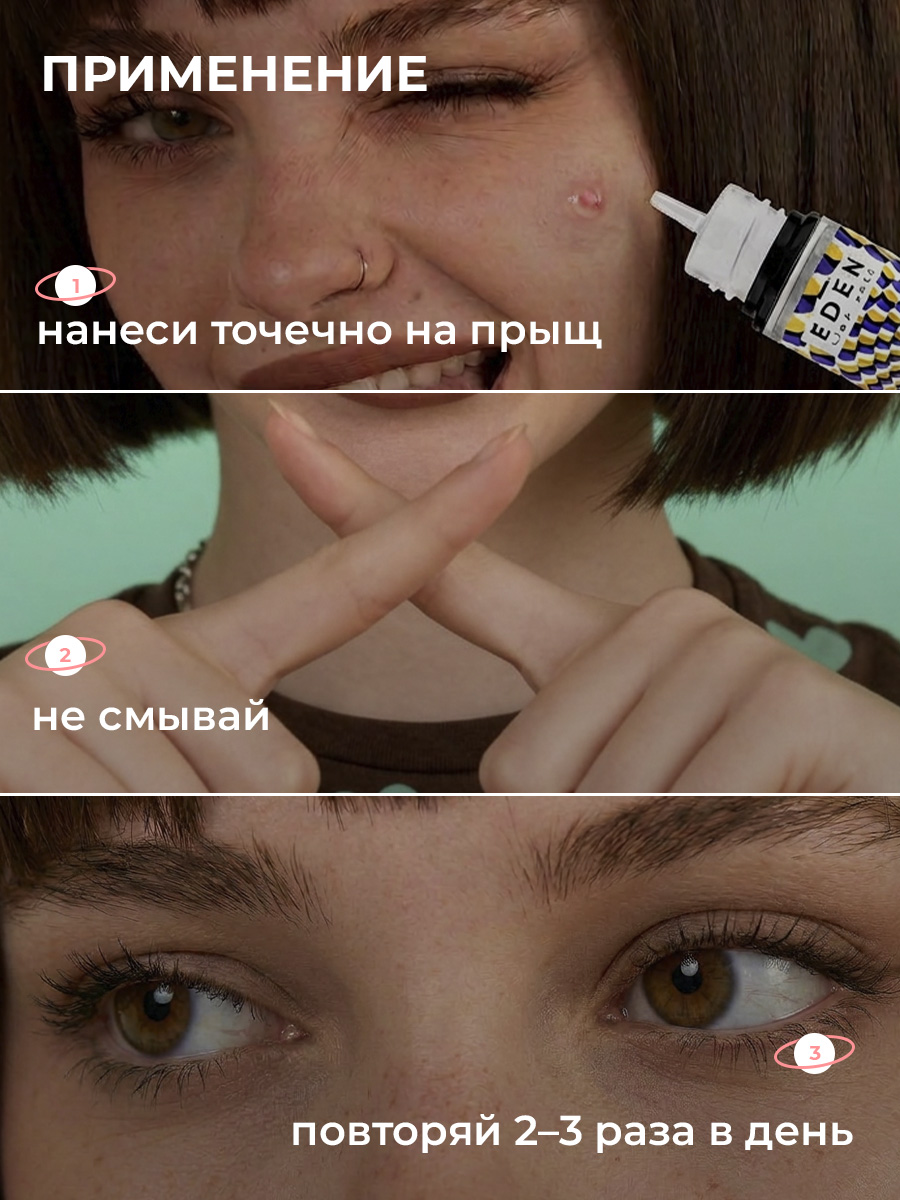 Гель EDEN Stop Acne 30 мл - фото 13