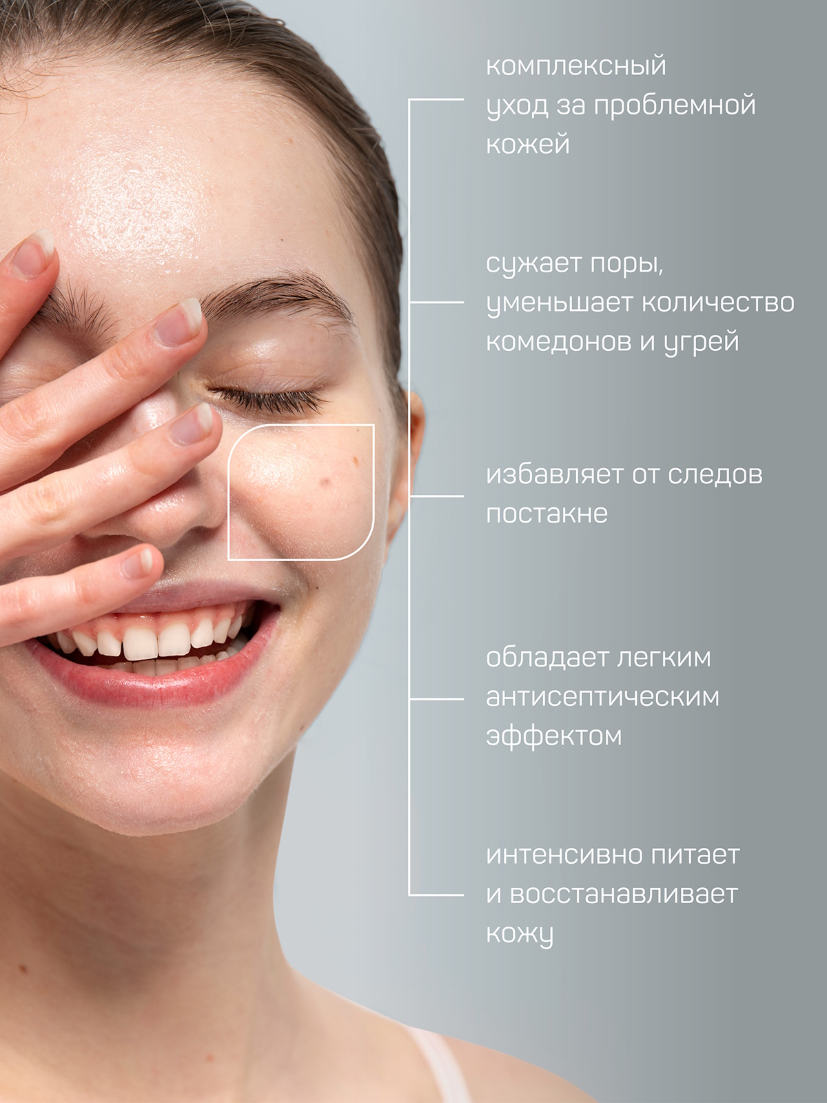Сыворотка Green Mama Anti acne 30 мл - фото 2