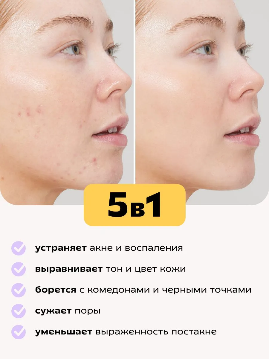 Сыворотка Краснополянская косметика для лица Муцин и Ниацинамид 30 мл 1 шт. - фото 2