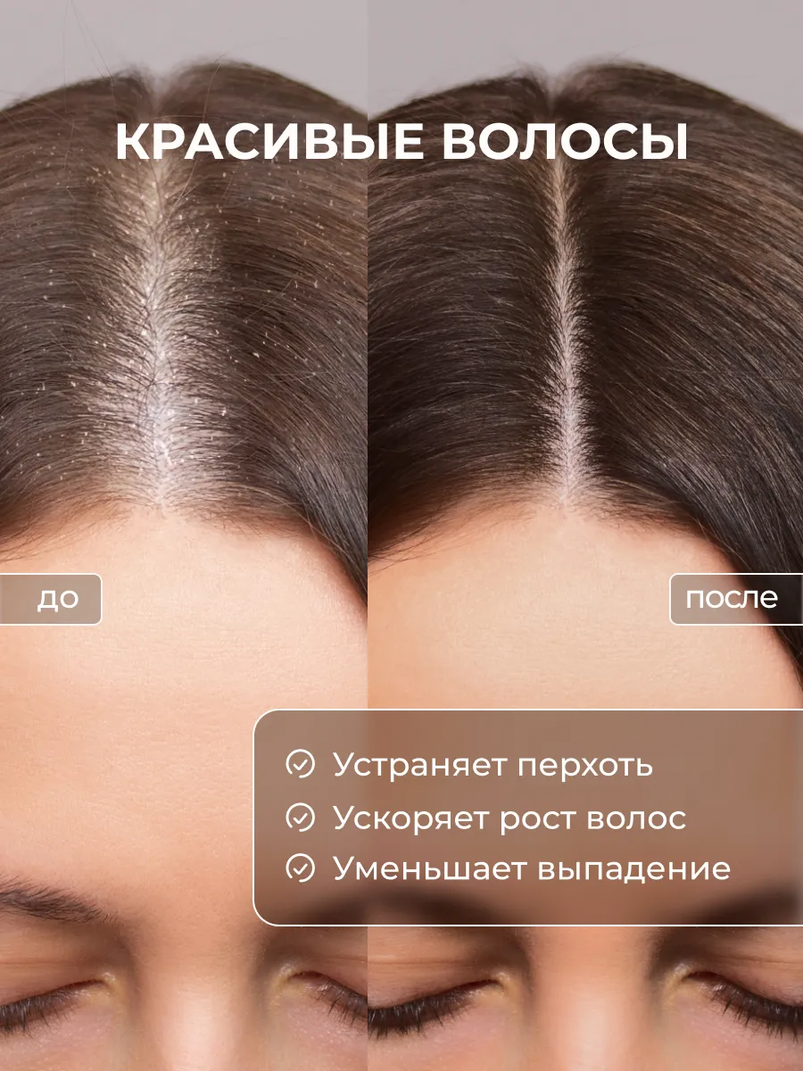 Био масло для кутикулы Qtix экстракт монарды и зелёный чай - фото 4