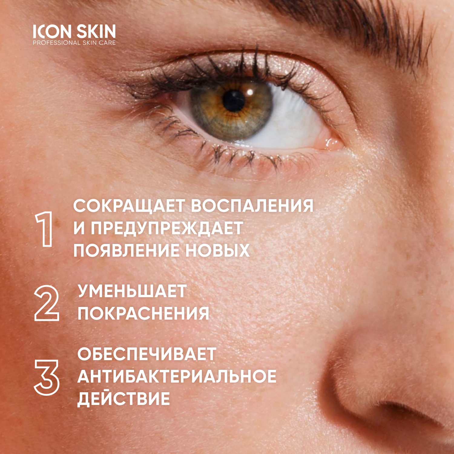 Гель ICON SKIN SOS Treatment - фото 2