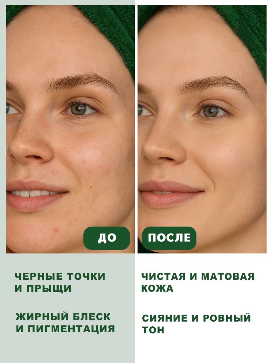 Пилинг GREENAURUM - фото 3