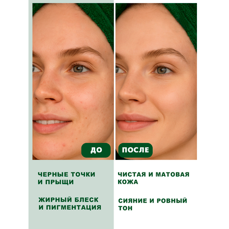 Пилинг GREENAURUM
