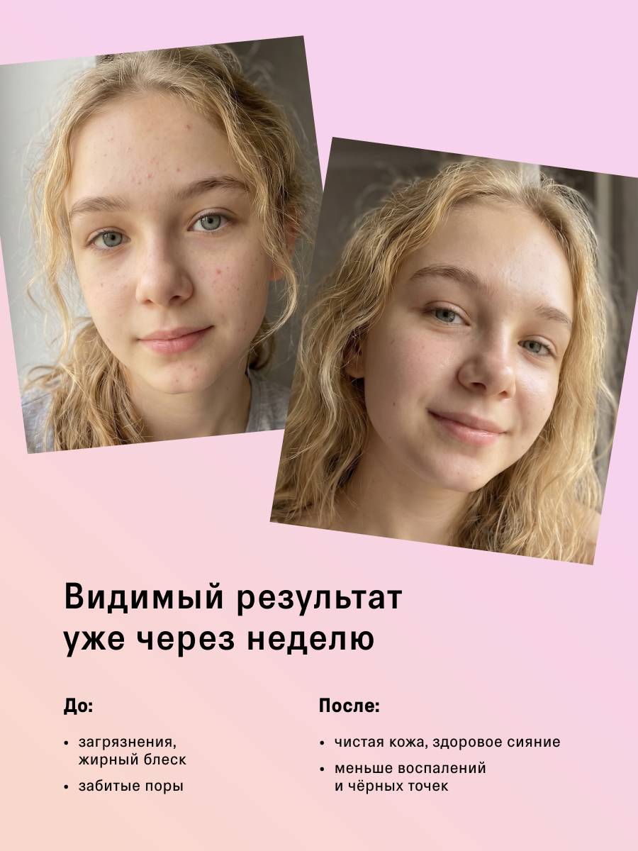 Гель The Act для умывания молодой кожи 150 мл - фото 4
