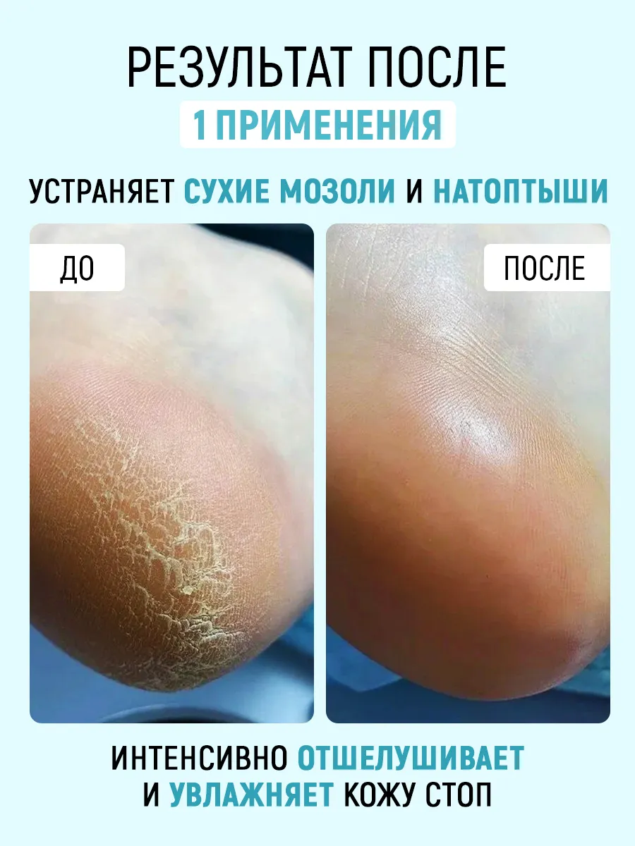 Набор CORIMO педикюр - фото 7