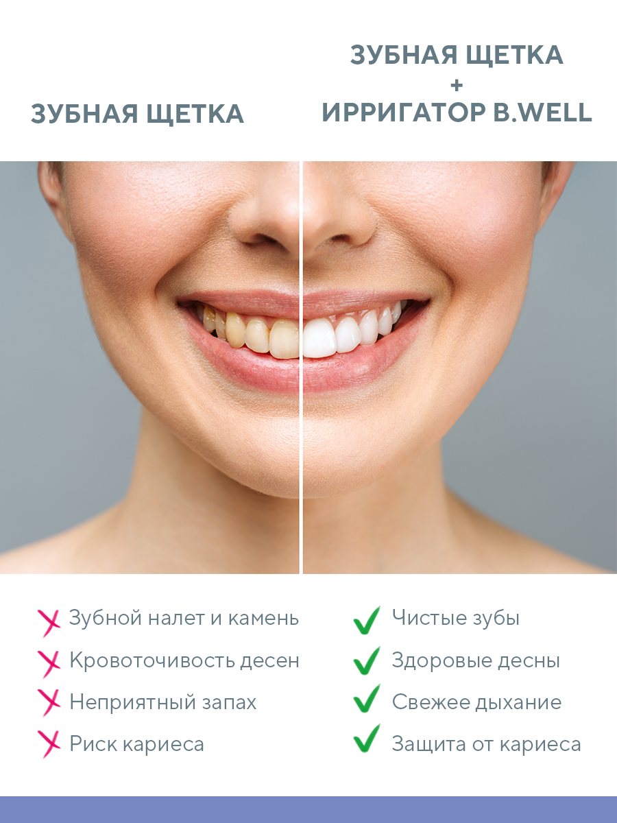 Ирригатор B.Well импульсный 20 реж. - фото 9