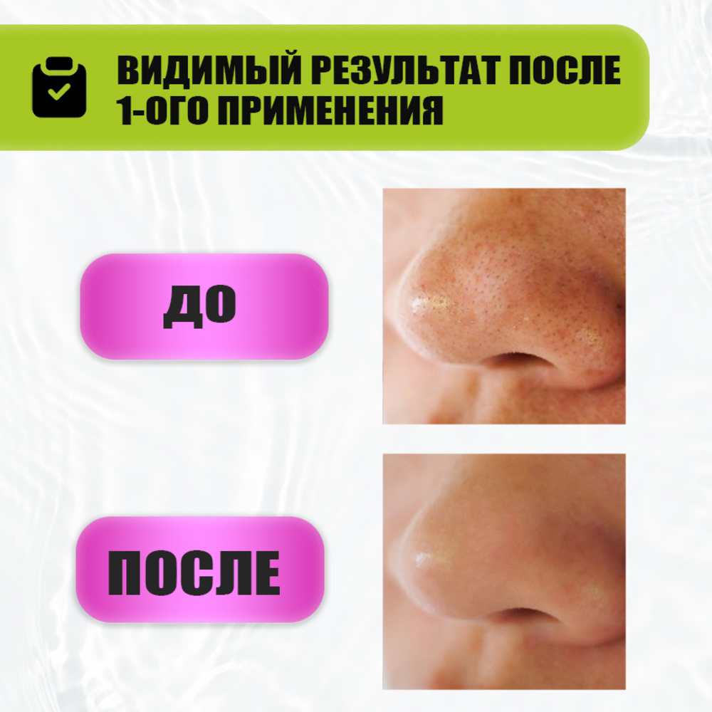 Скраб EDEN Stop Acne 75 мл - фото 3
