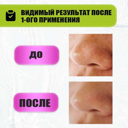 Скраб EDEN Stop Acne 75 мл