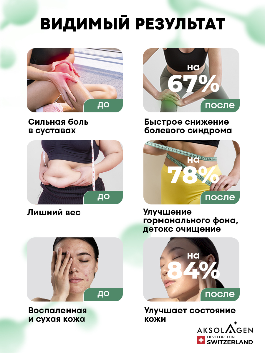 Морской коллаген 2 типа AKSOLAGEN с экстрактом чаги - фото 2