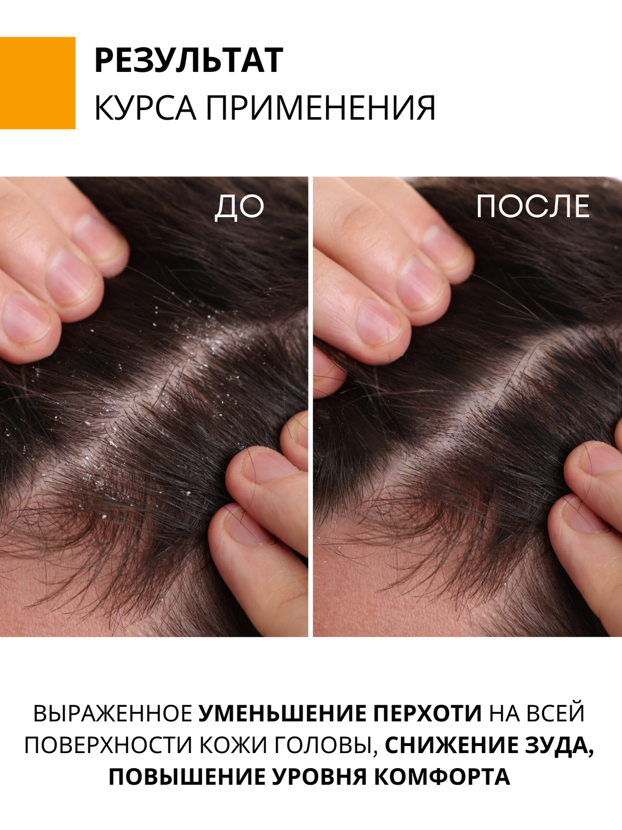 Шампунь DR. MARCUS HEILER 250 мл - фото 6