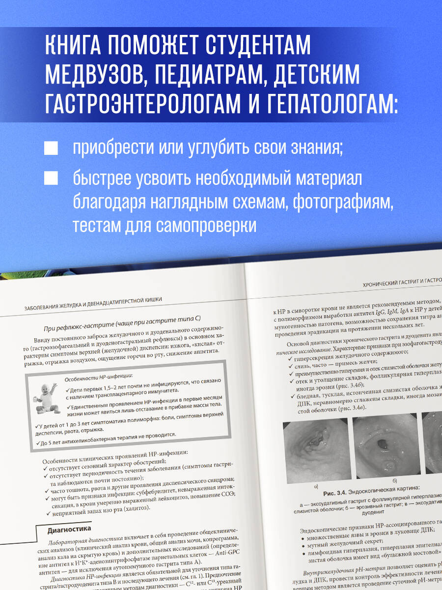 Книга Эксмо Наглядная детская гастроэнтерология и гепатология. Учебное пособие - фото 3