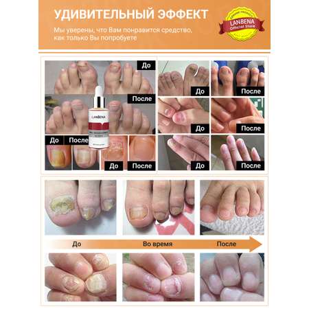 Крем LANBENA