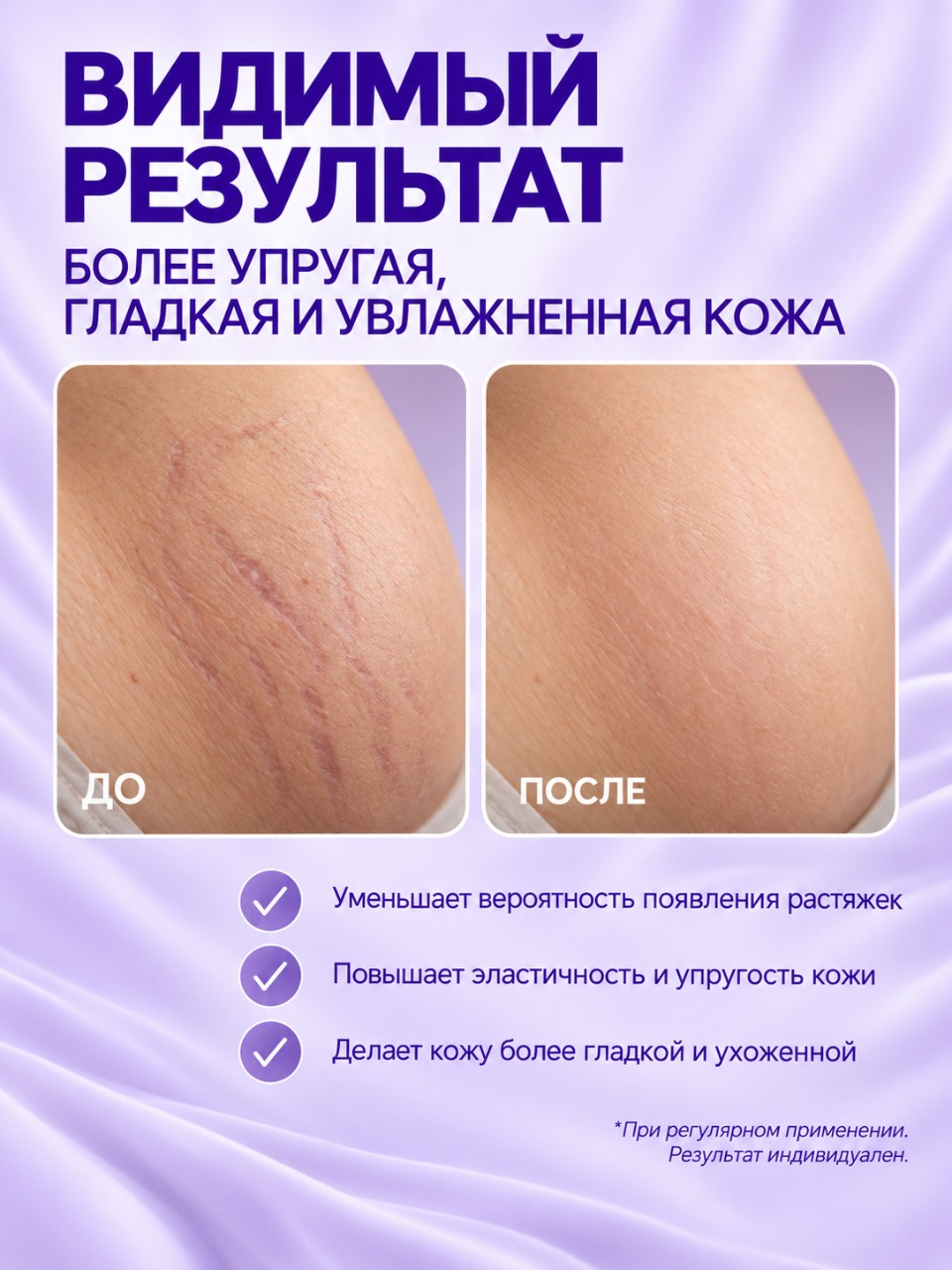 Крем Mama Com.fort от растяжек для беременных 150 мл - фото 4