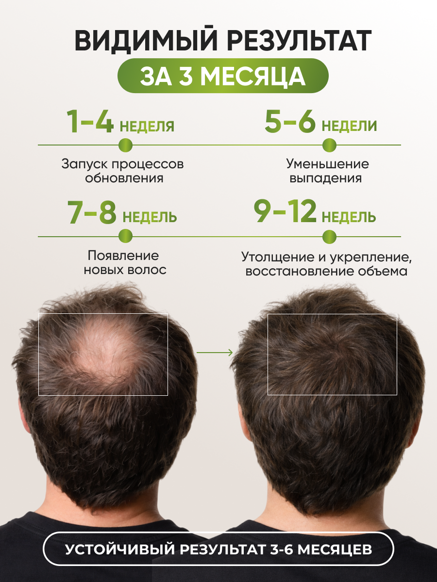 Лосьон Ринфолтил 100 мл - фото 3