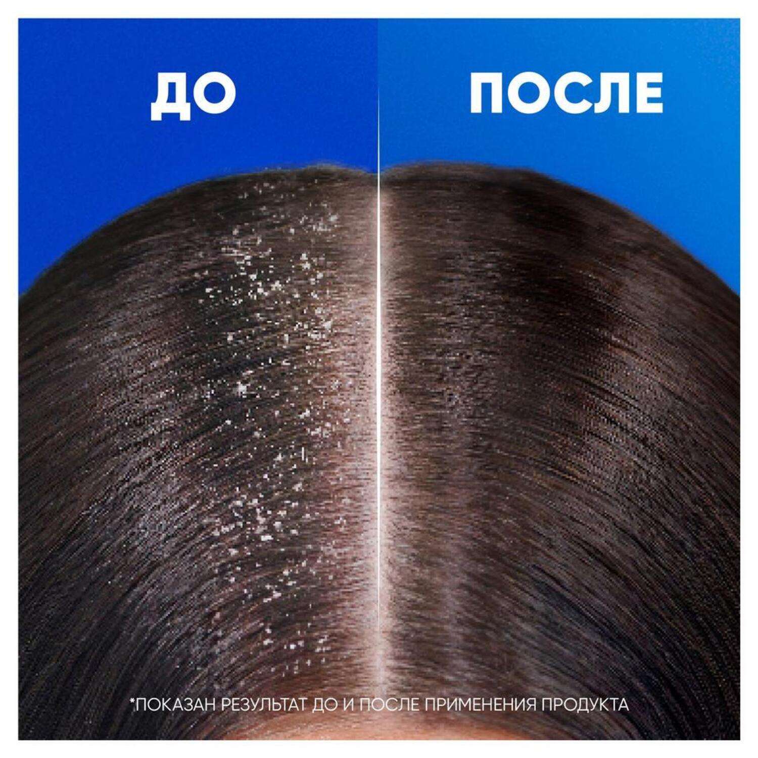 Шампунь Head and Shoulders 2в1 Ментол 360 мл - фото 6