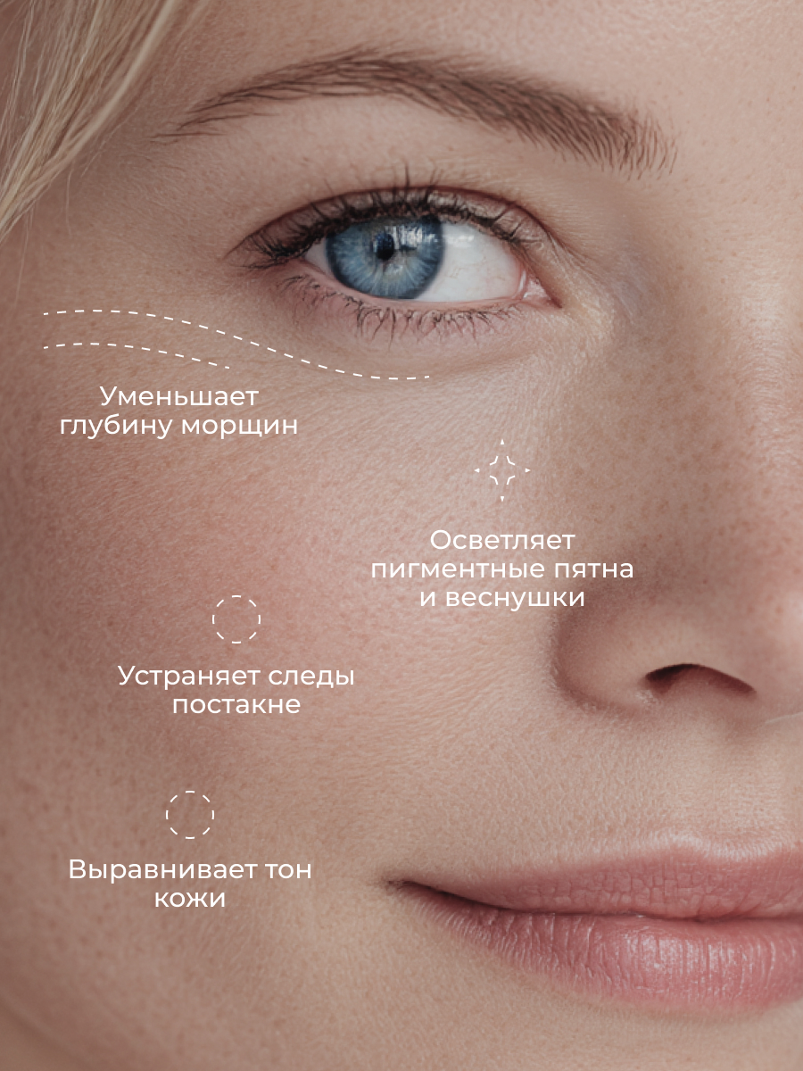 Сыворотка АКАВИЯ - фото 5