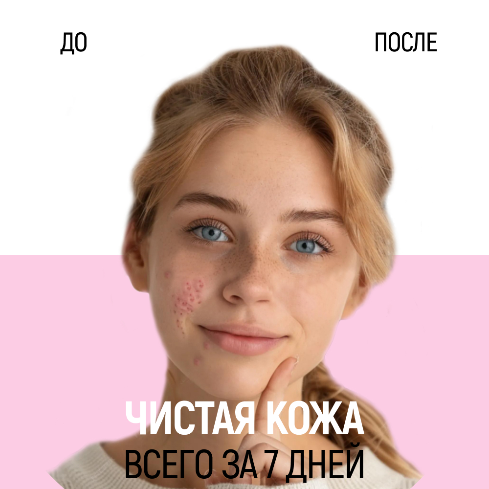 Скраб Siberina От прыщей 50 мл - фото 6