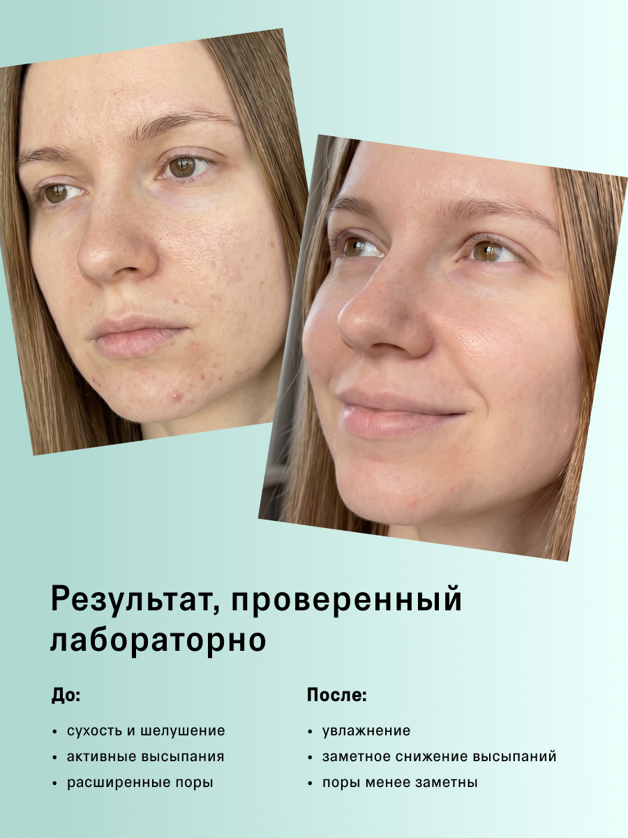 Сыворотка The Act для проблемной кожи лица 50 мл - фото 4