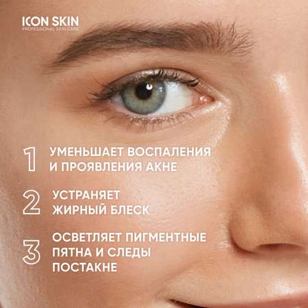 Сыворотка ICON SKIN с азелаиновой кислотой