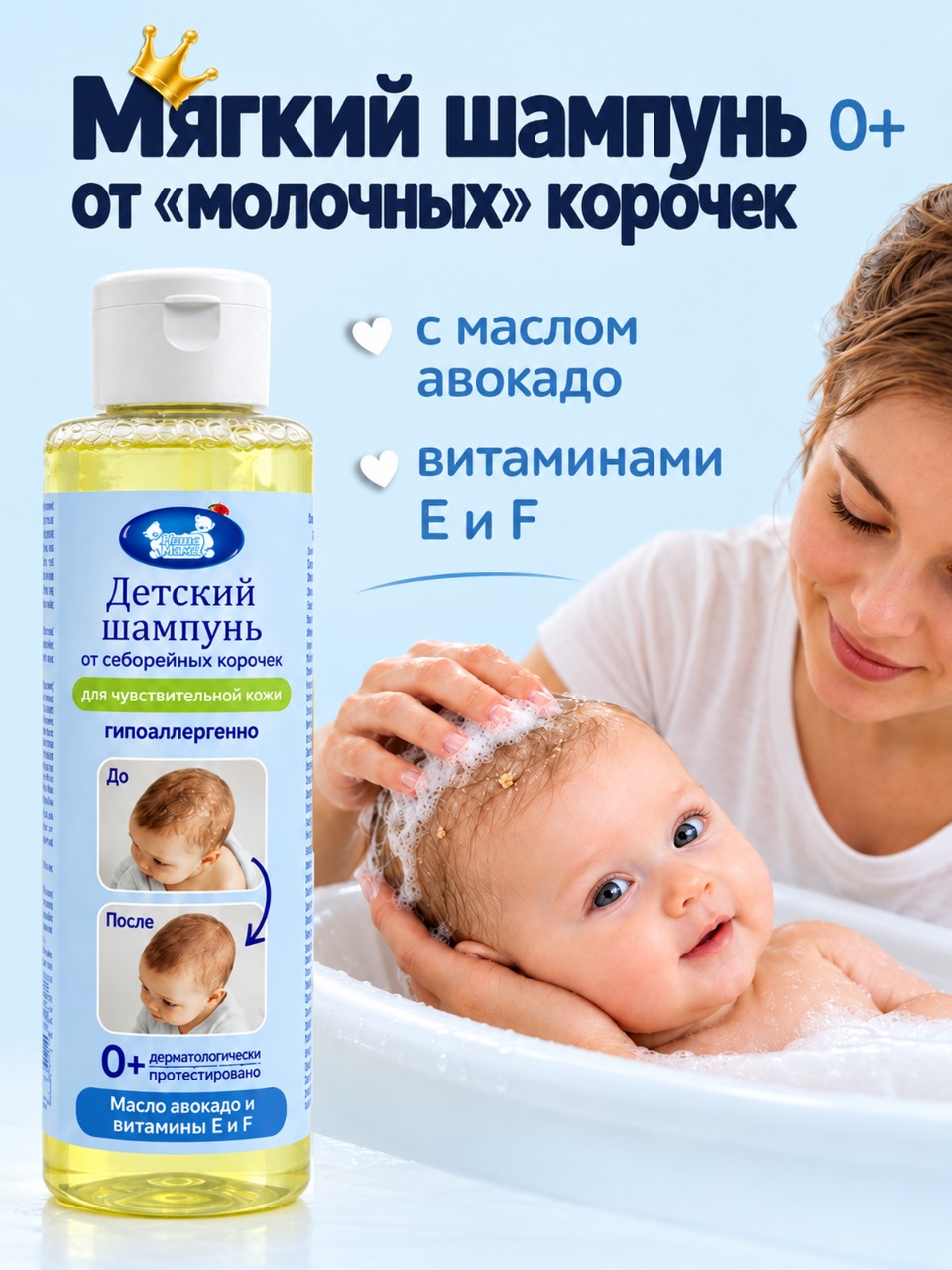 Шампунь Наша Мама от молочных корочек на голове 150 мл - фото 1