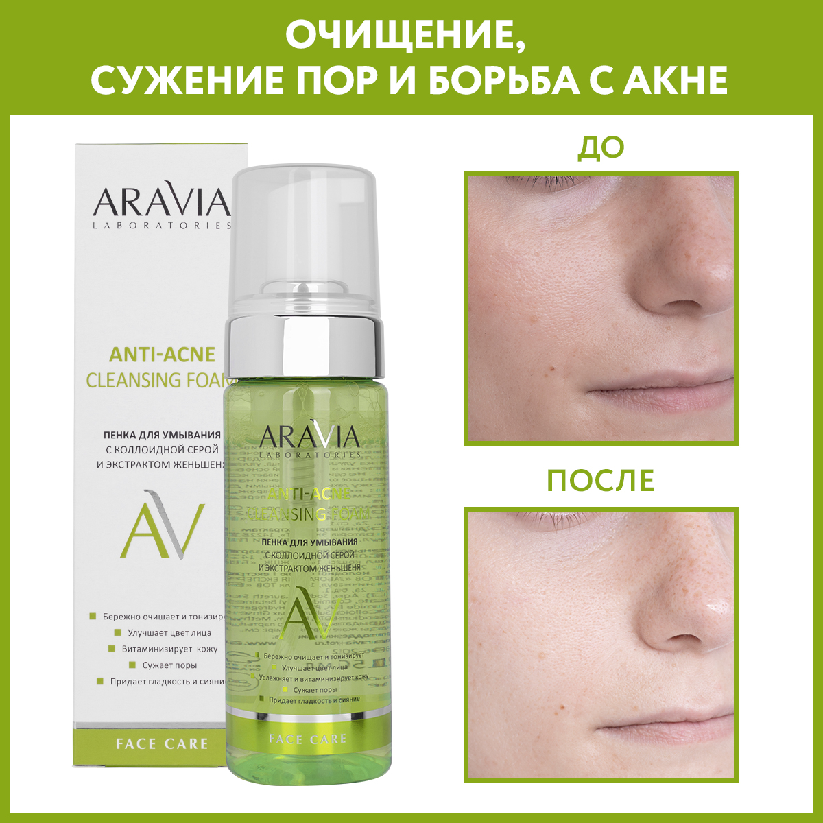 Пена ARAVIA Laboratories Anti-Acne 150 мл - фото 2