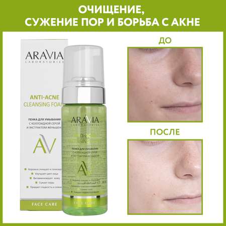 Пена ARAVIA Laboratories Anti-Acne 150 мл
