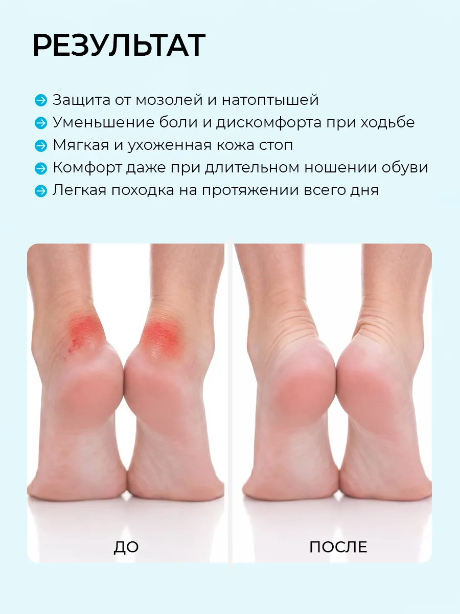 Немозоль CORIMO защита - фото 6