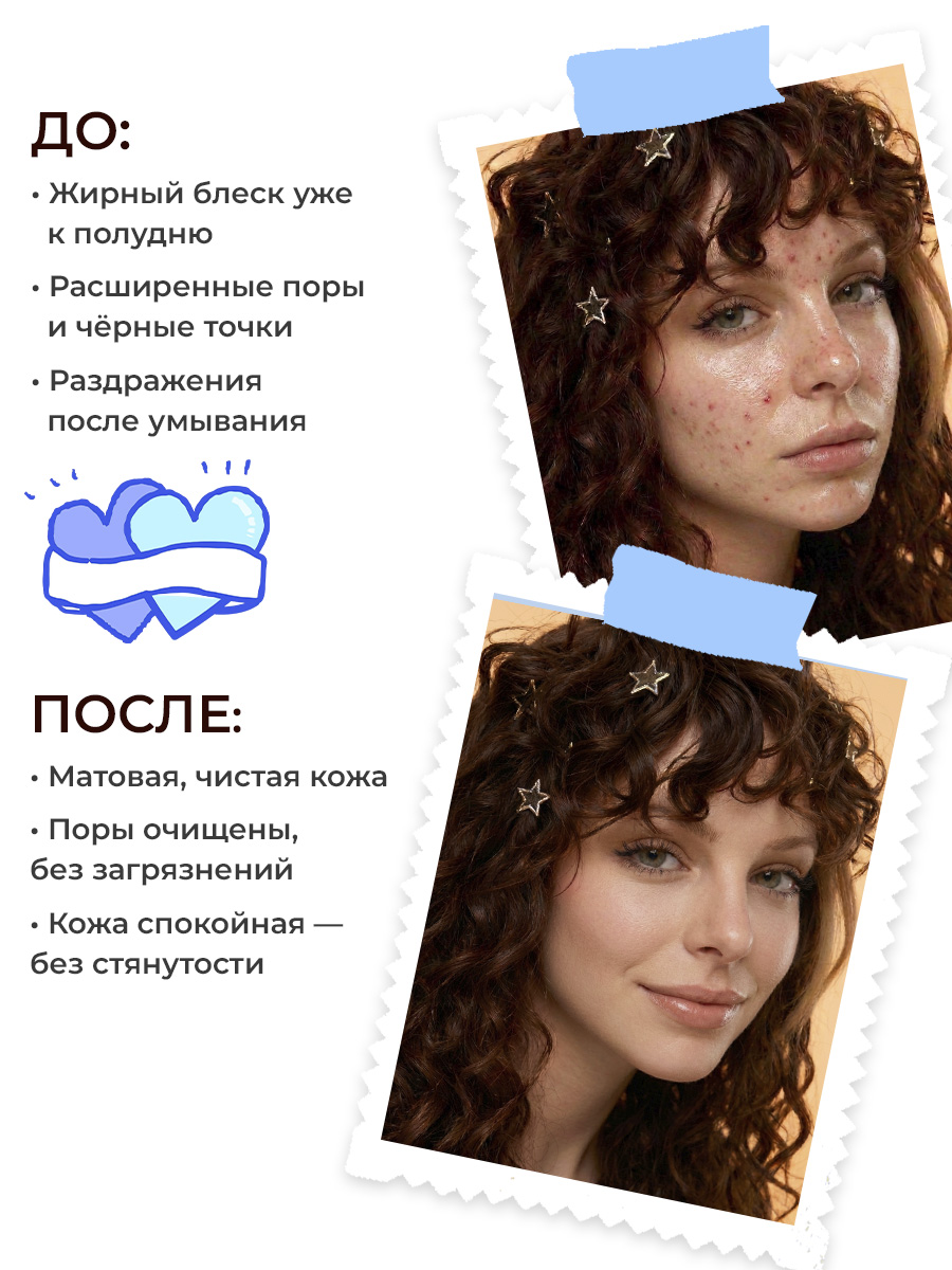 Гель EDEN Stop Acne 150 мл - фото 6
