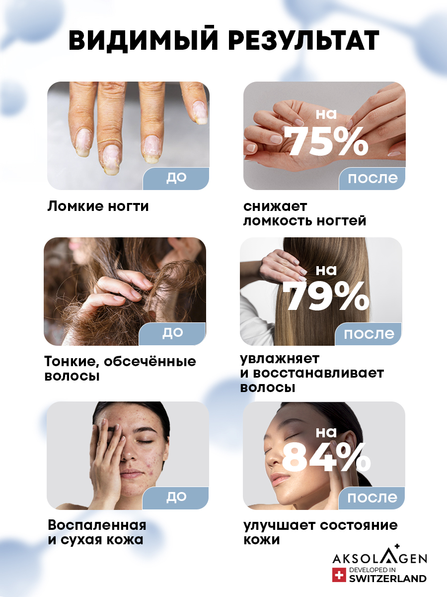 Морской Коллаген 1 2 3 типа AKSOLAGEN красота и здоровье без добавок - фото 2