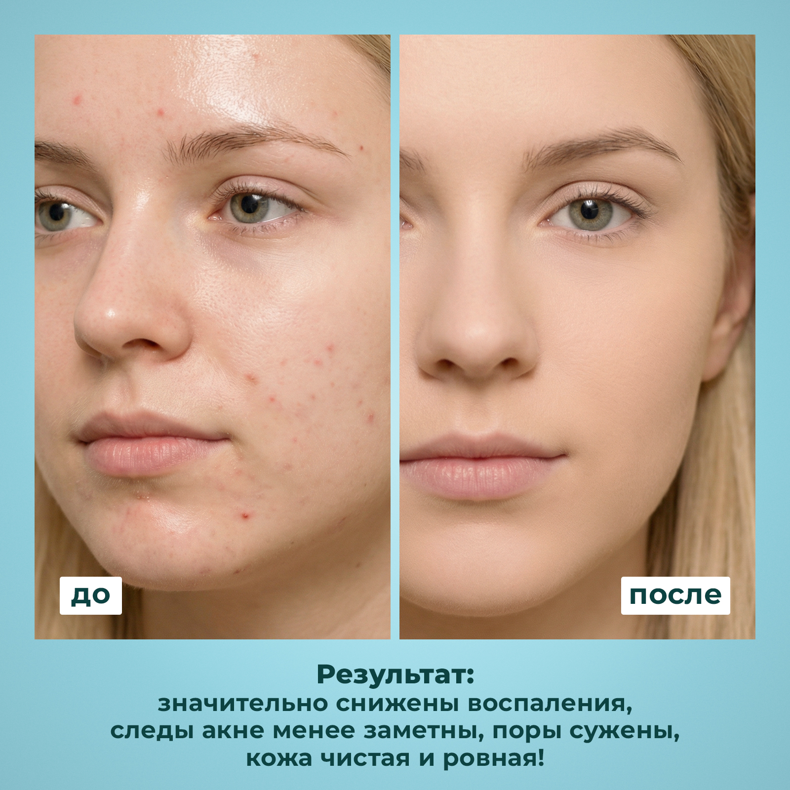 Крем-маска NUZHNOE 100 мл 1 шт. - фото 2