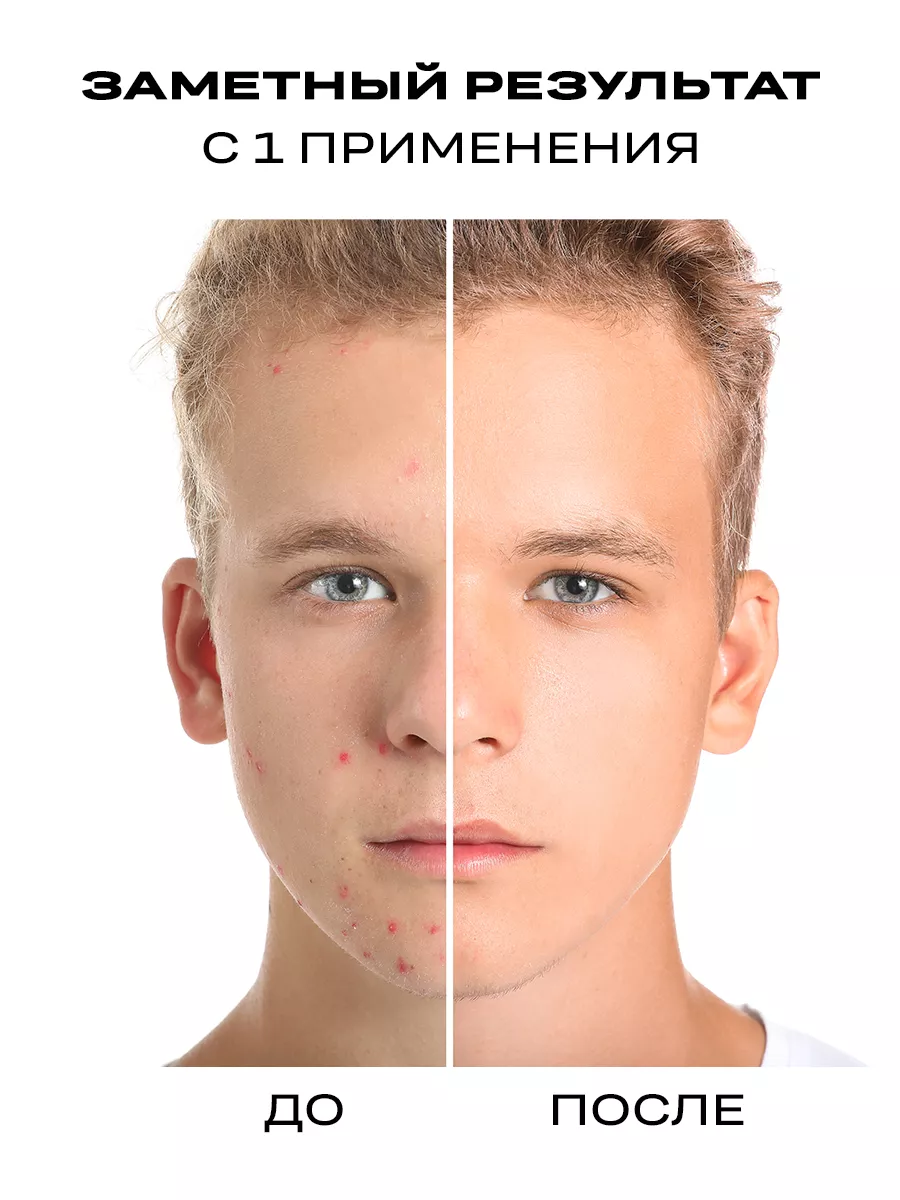 Патчи Funny Organix - фото 3