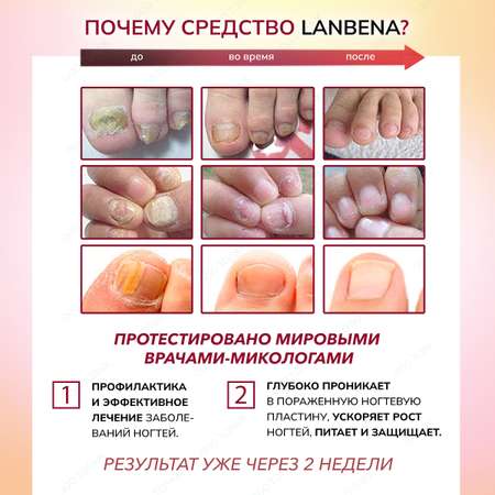 Крем LANBENA