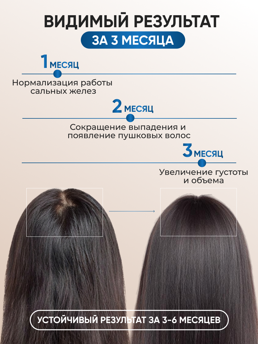 Спрей Ринфолтил От выпадения Для жирной кожи 100 мл - фото 3