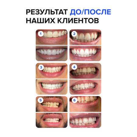 Зубной гель EMRA