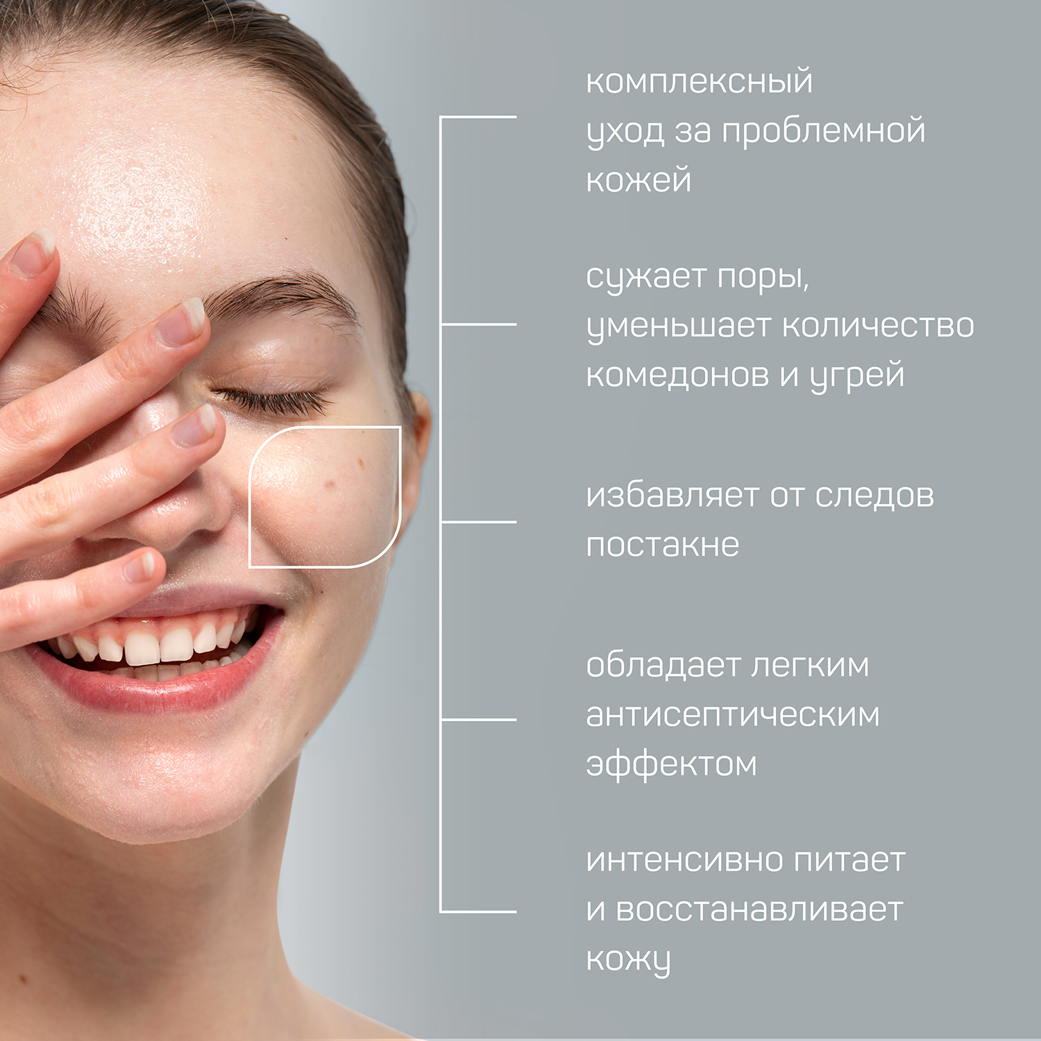 Сыворотка Green Mama Anti acne 30 мл - фото 3