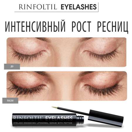 Сыворотка Ринфолтил Ресницы Липосомальная для роста ресниц с пептидом 4 мл