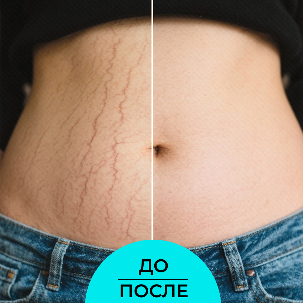 Крем Siberina - фото 6