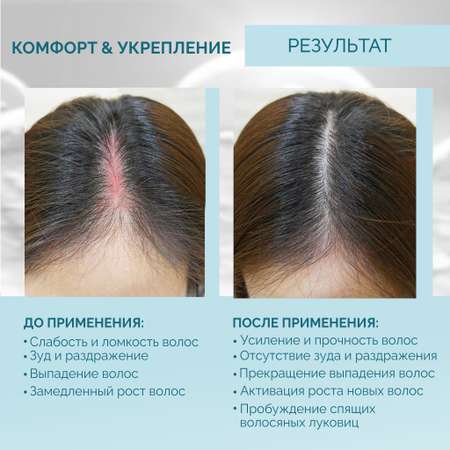Спрей Ринфолтил 100 мл