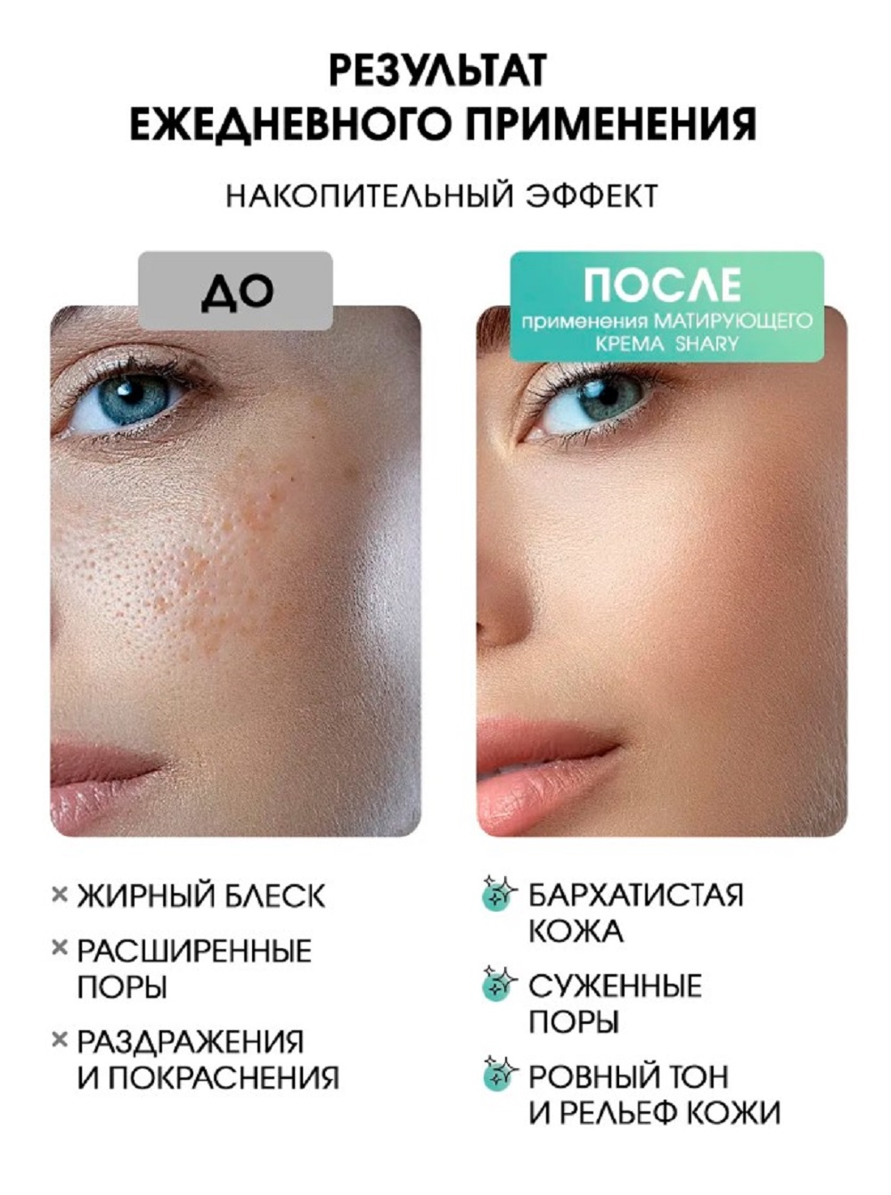 Крем SHARY Perfect Skin для лица 50 г - фото 3