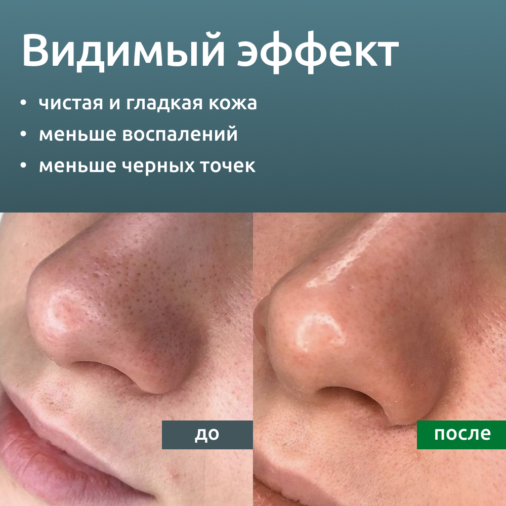 Гель ReadySkin Care Ultraclean Gel - фото 6