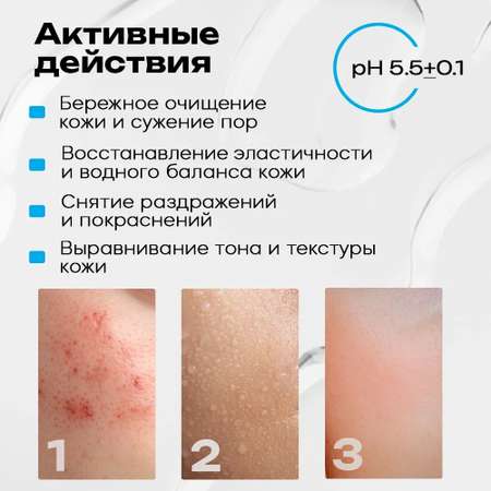 Пена Ichthyonella