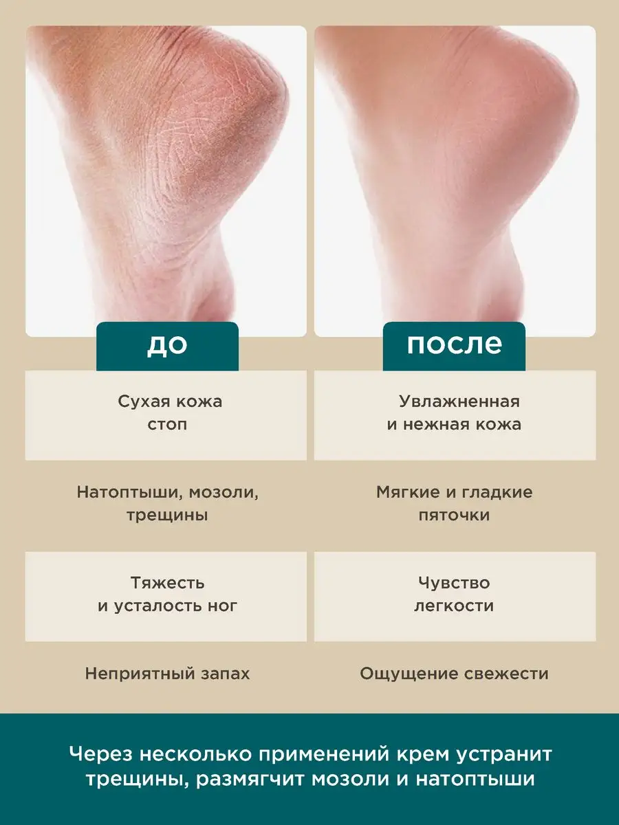 Крем PERFECT4U для ног увлажняющий 100 мл - фото 2