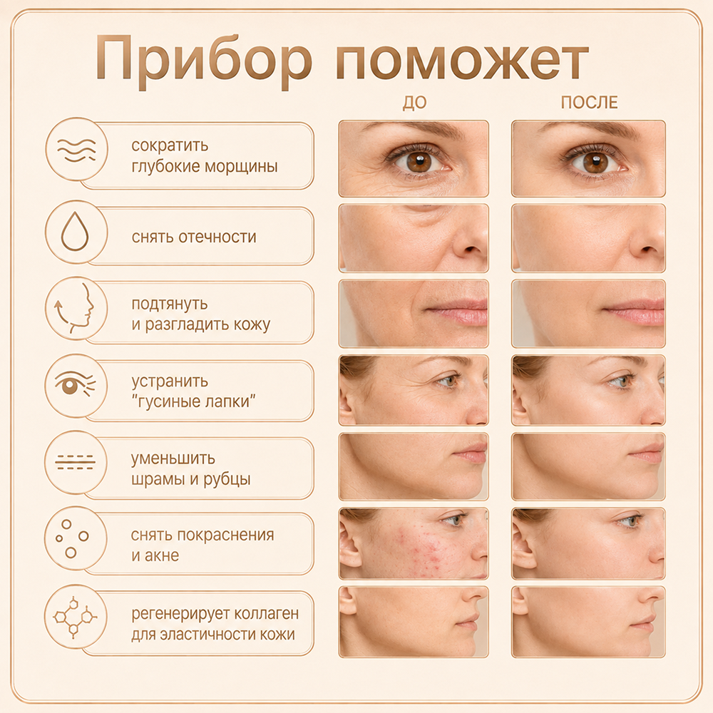 Прибор LUXLIFTING RF-лифтинг, LED, EMS, согревание - фото 6