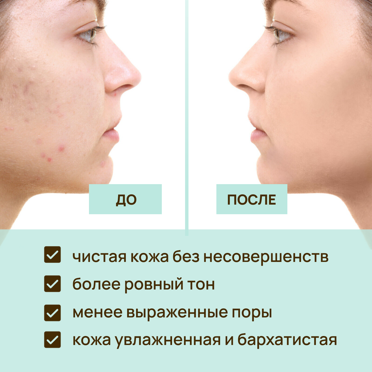 Сыворотка KLEONA 25 мл - фото 4