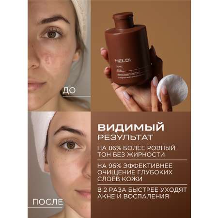 Тоник HELDI 300 мл