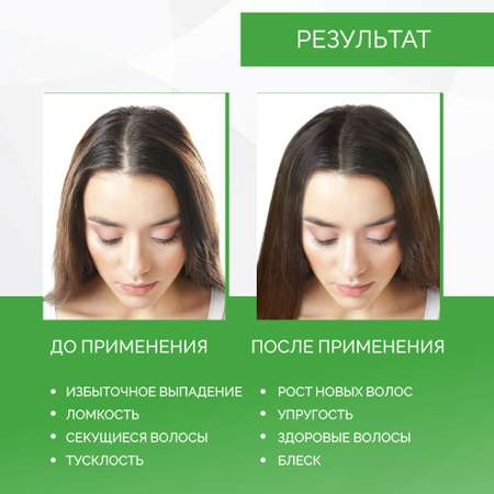 Спрей Ринфолтил 100 мл