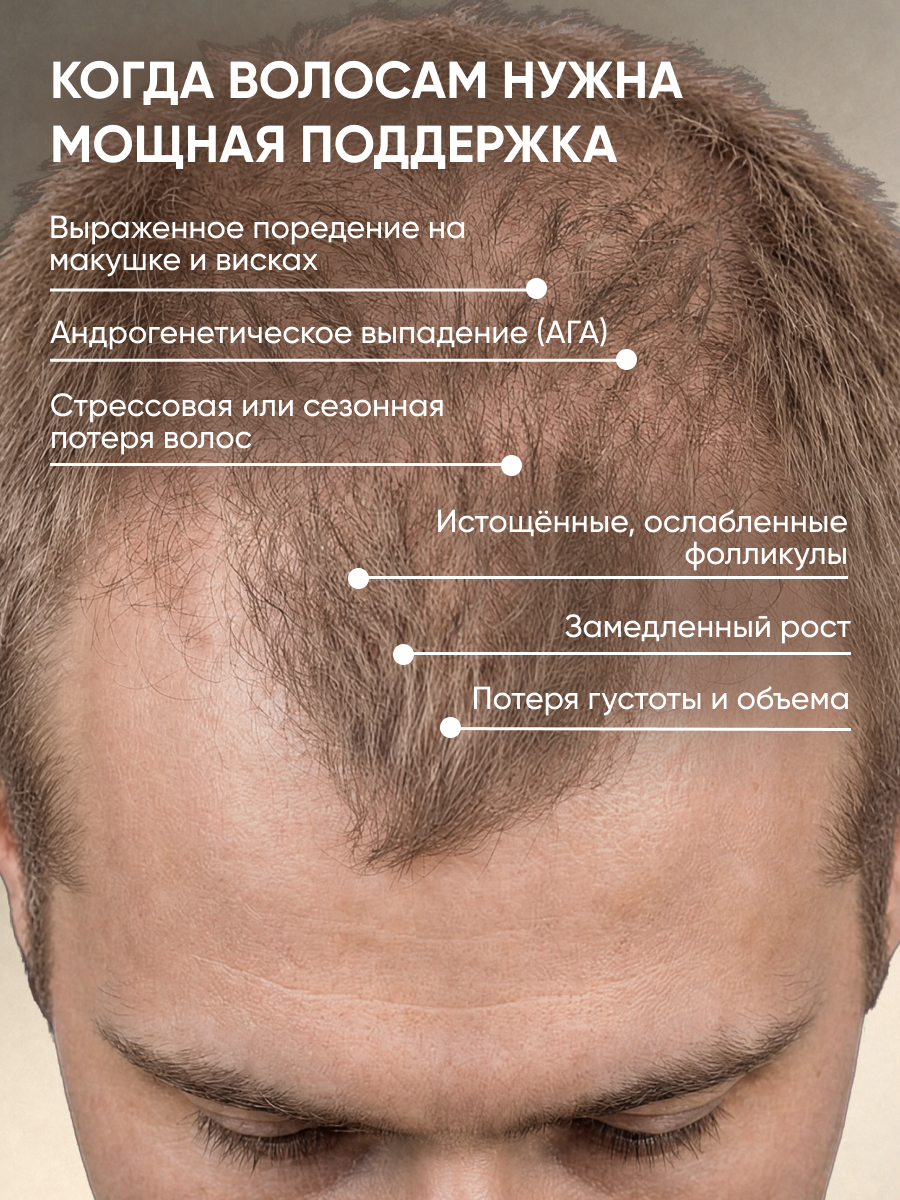 Бальзам Ринфолтил с кофеином для мужчин 10 по 10 100 мл - фото 3